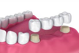 SOLACE FAMILY DENTAL CARE PATTIKKAD